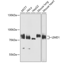 Western Blot - Anti-LIMD1 Antibody (A307140) - Antibodies.com