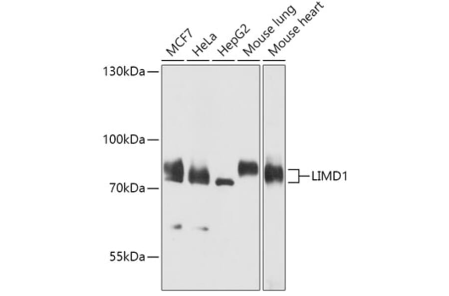 Western Blot - Anti-LIMD1 Antibody (A307140) - Antibodies.com