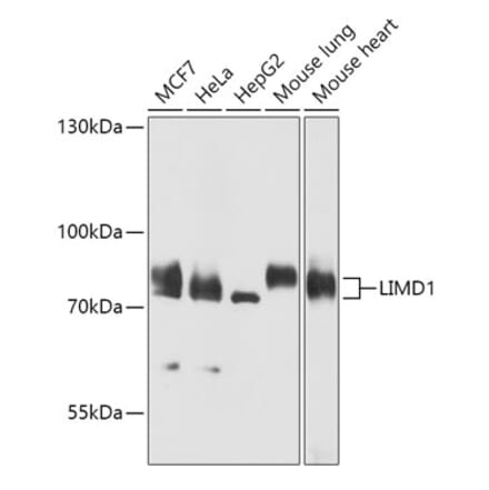 Western Blot - Anti-LIMD1 Antibody (A307140) - Antibodies.com