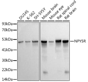 Western Blot - Anti-NPY5R Antibody [ARC2758] (A307141) - Antibodies.com