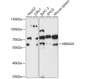 Western Blot - Anti-Hemogen Antibody (A307142) - Antibodies.com