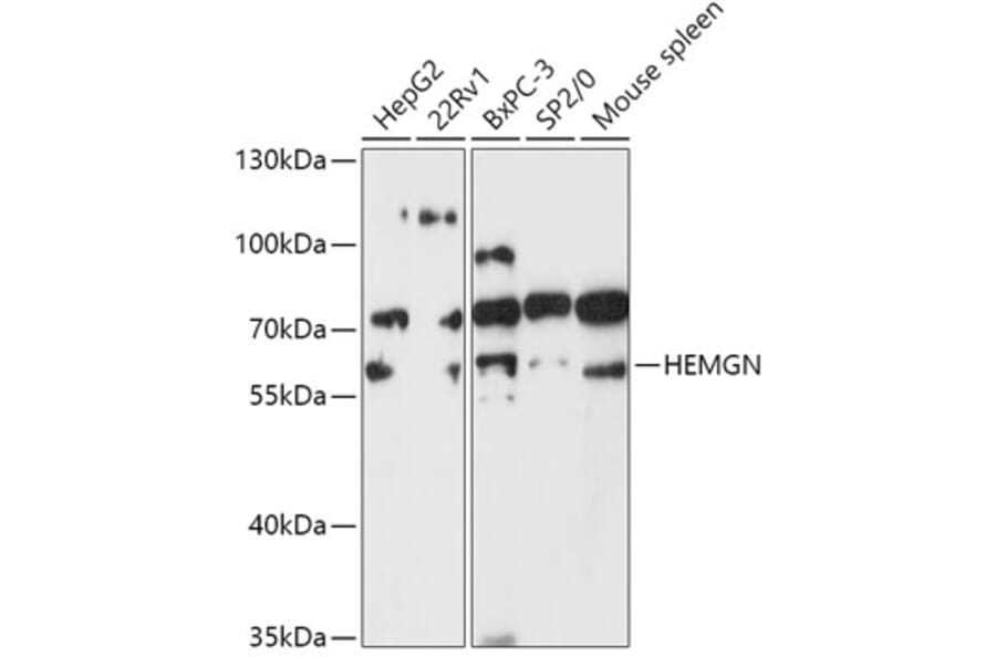 Western Blot - Anti-Hemogen Antibody (A307142) - Antibodies.com