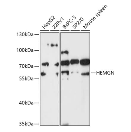 Western Blot - Anti-Hemogen Antibody (A307142) - Antibodies.com