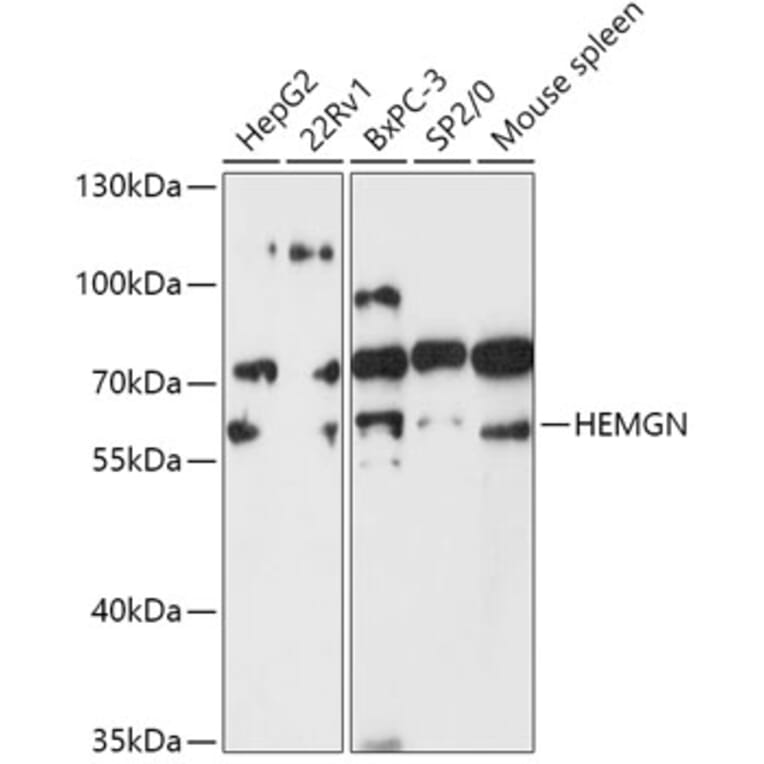 Western Blot - Anti-Hemogen Antibody (A307142) - Antibodies.com