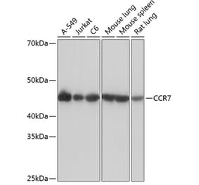 Western Blot - Anti-CCR7 Antibody [ARC0231] (A307143) - Antibodies.com