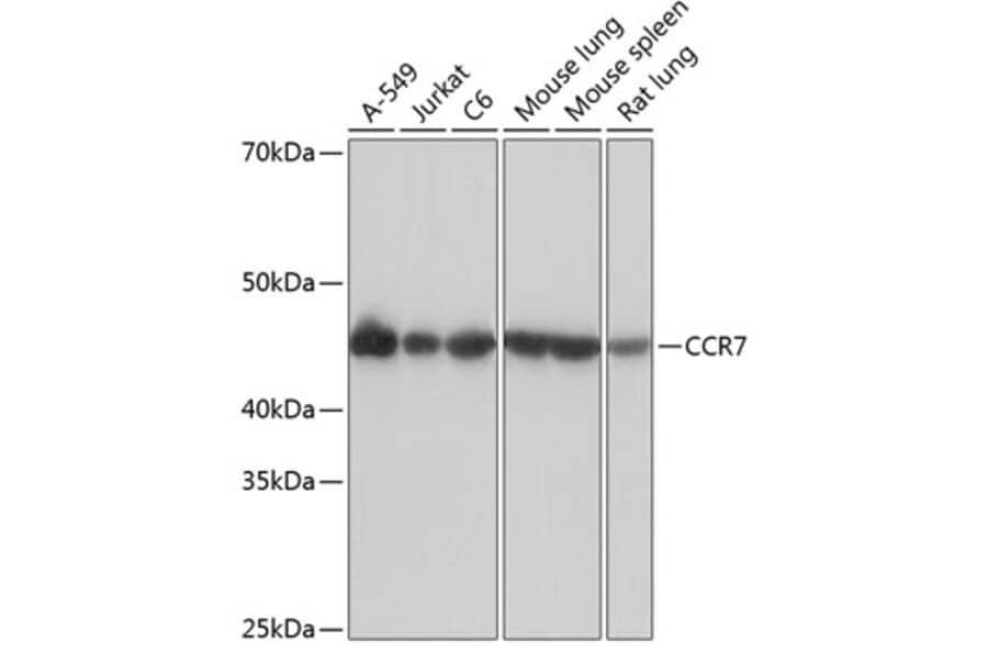 Western Blot - Anti-CCR7 Antibody [ARC0231] (A307143) - Antibodies.com