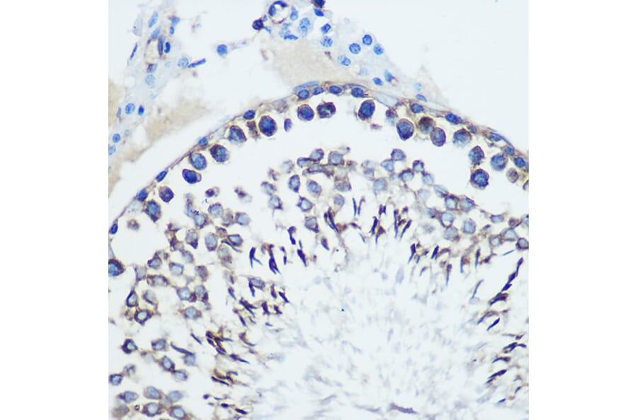 Immunohistochemistry - Anti-CCR7 Antibody [ARC0231] (A307143) - Antibodies.com
