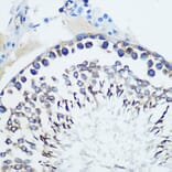 Immunohistochemistry - Anti-CCR7 Antibody [ARC0231] (A307143) - Antibodies.com