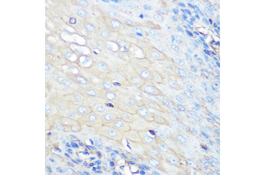 Immunohistochemistry - Anti-CCR7 Antibody [ARC0231] (A307143) - Antibodies.com
