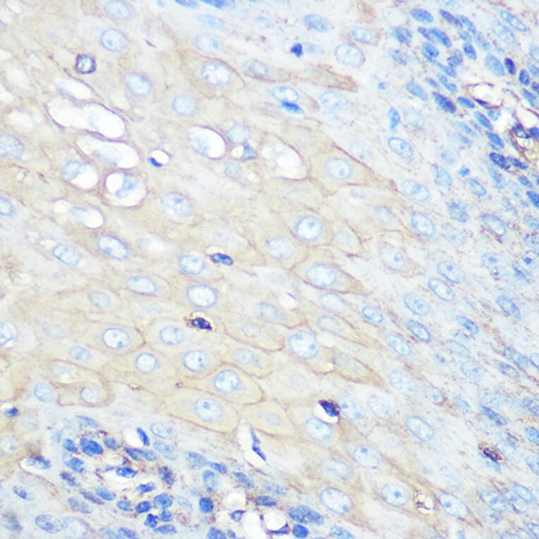 Immunohistochemistry - Anti-CCR7 Antibody [ARC0231] (A307143) - Antibodies.com