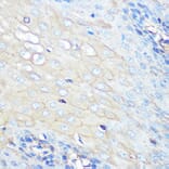Immunohistochemistry - Anti-CCR7 Antibody [ARC0231] (A307143) - Antibodies.com