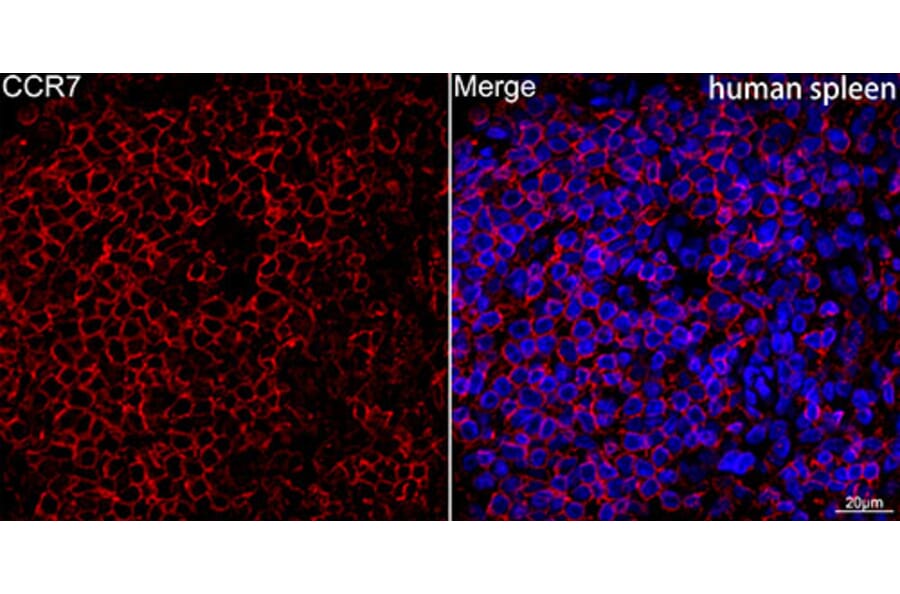 Immunofluorescence - Anti-CCR7 Antibody [ARC0231] (A307143) - Antibodies.com