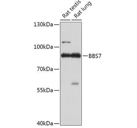 Western Blot - Anti-BBS7 Antibody (A307144) - Antibodies.com