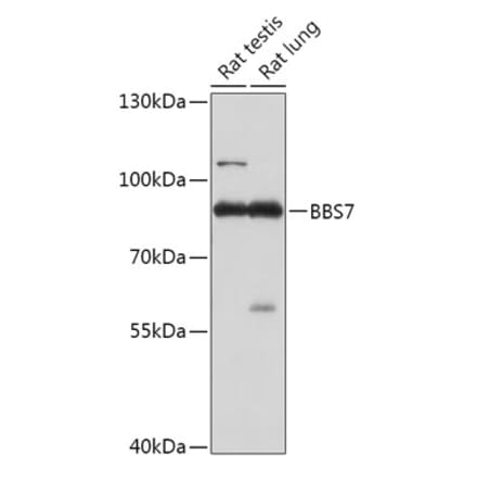 Western Blot - Anti-BBS7 Antibody (A307144) - Antibodies.com