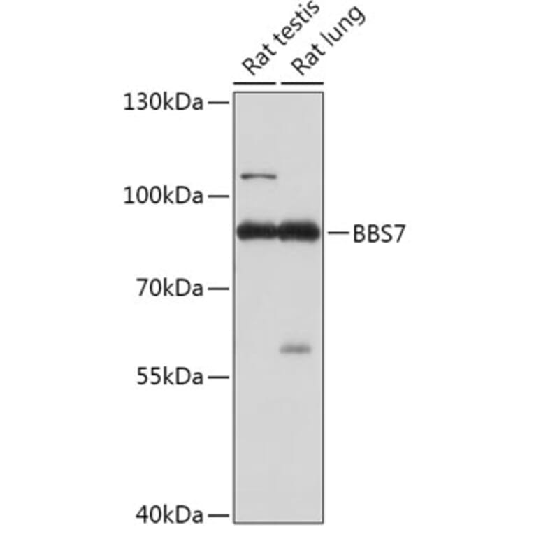 Western Blot - Anti-BBS7 Antibody (A307144) - Antibodies.com