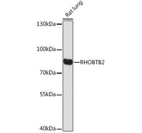Western Blot - Anti-RHOBTB2 Antibody (A307145) - Antibodies.com