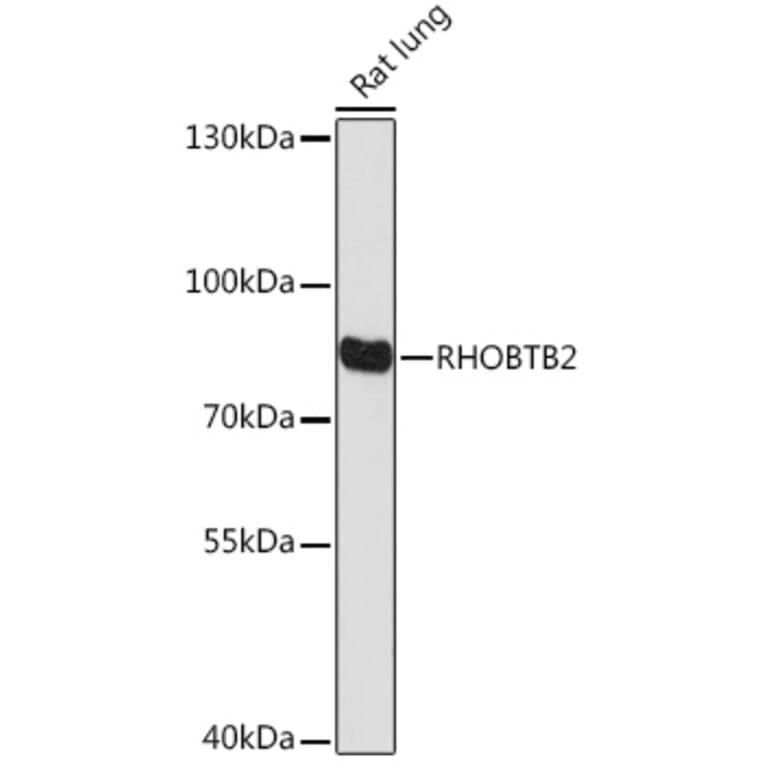 Western Blot - Anti-RHOBTB2 Antibody (A307145) - Antibodies.com