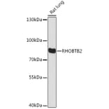 Western Blot - Anti-RHOBTB2 Antibody (A307145) - Antibodies.com