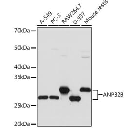 Western Blot - Anti-PHAPI2 / APRIL Antibody [ARC2014] (A307147) - Antibodies.com