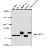Western Blot - Anti-PHAPI2/APRIL Antibody [ARC2014] (A307147) - Antibodies.com