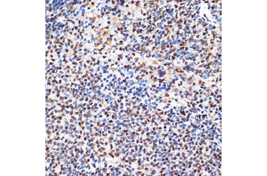 Immunohistochemistry - Anti-PHAPI2/APRIL Antibody [ARC2014] (A307147) - Antibodies.com