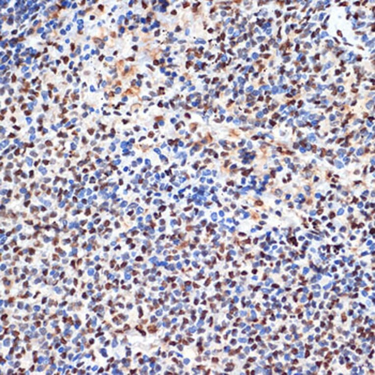 Immunohistochemistry - Anti-PHAPI2/APRIL Antibody [ARC2014] (A307147) - Antibodies.com