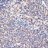 Immunohistochemistry - Anti-PHAPI2/APRIL Antibody [ARC2014] (A307147) - Antibodies.com
