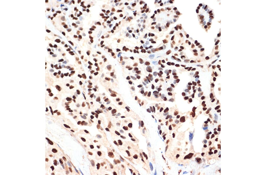 Immunohistochemistry - Anti-PHAPI2/APRIL Antibody [ARC2014] (A307147) - Antibodies.com