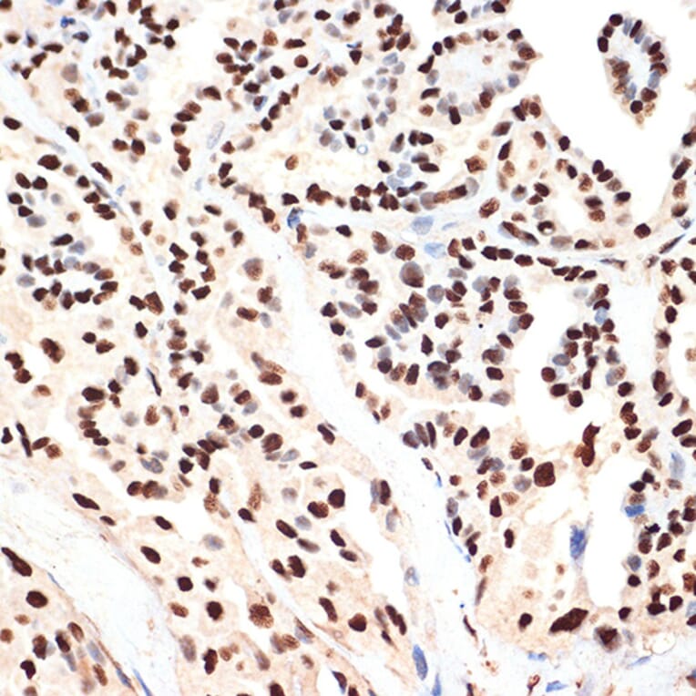Immunohistochemistry - Anti-PHAPI2/APRIL Antibody [ARC2014] (A307147) - Antibodies.com