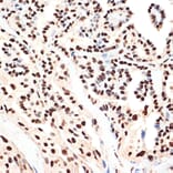 Immunohistochemistry - Anti-PHAPI2/APRIL Antibody [ARC2014] (A307147) - Antibodies.com