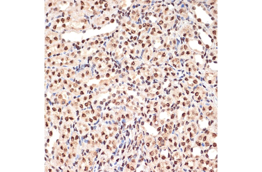 Immunohistochemistry - Anti-PHAPI2/APRIL Antibody [ARC2014] (A307147) - Antibodies.com