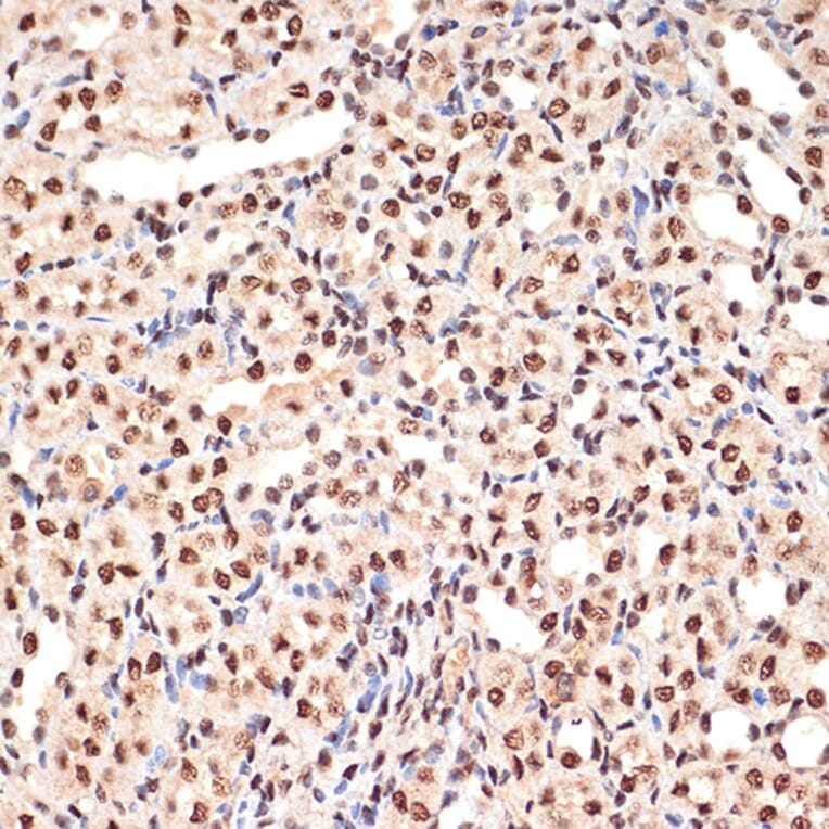 Immunohistochemistry - Anti-PHAPI2/APRIL Antibody [ARC2014] (A307147) - Antibodies.com