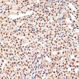 Immunohistochemistry - Anti-PHAPI2/APRIL Antibody [ARC2014] (A307147) - Antibodies.com