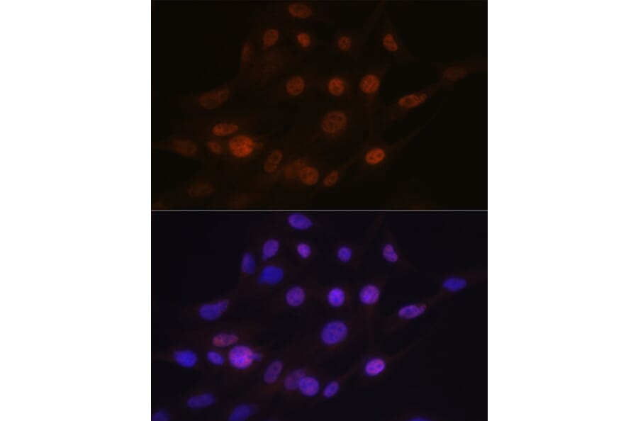 Immunofluorescence - Anti-PHAPI2/APRIL Antibody [ARC2014] (A307147) - Antibodies.com