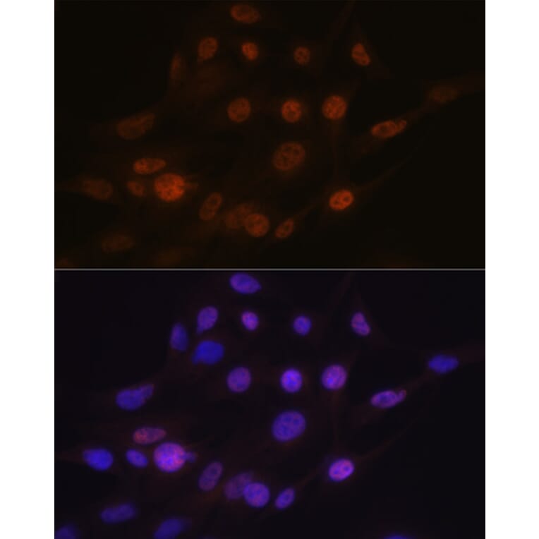 Immunofluorescence - Anti-PHAPI2/APRIL Antibody [ARC2014] (A307147) - Antibodies.com