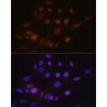 Immunofluorescence - Anti-PHAPI2/APRIL Antibody [ARC2014] (A307147) - Antibodies.com
