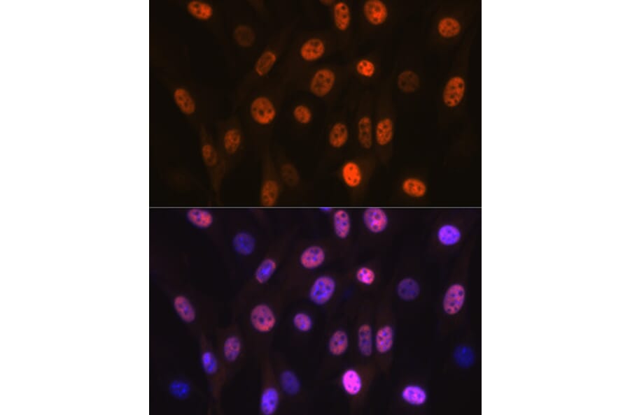 Immunofluorescence - Anti-PHAPI2/APRIL Antibody [ARC2014] (A307147) - Antibodies.com