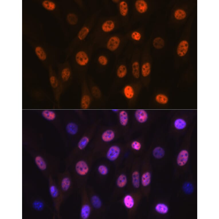 Immunofluorescence - Anti-PHAPI2/APRIL Antibody [ARC2014] (A307147) - Antibodies.com