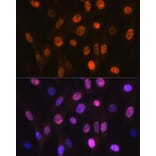 Immunofluorescence - Anti-PHAPI2/APRIL Antibody [ARC2014] (A307147) - Antibodies.com