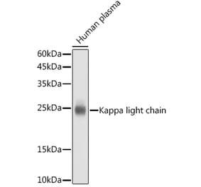 Western Blot - Anti-Human Kappa Light Chain Antibody [ARC2527] (A307148) - Antibodies.com