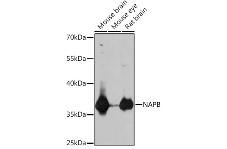 Western Blot - Anti-SNAP-beta Antibody (A307149) - Antibodies.com