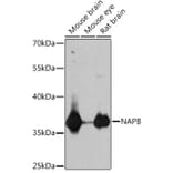 Western Blot - Anti-SNAP-beta Antibody (A307149) - Antibodies.com