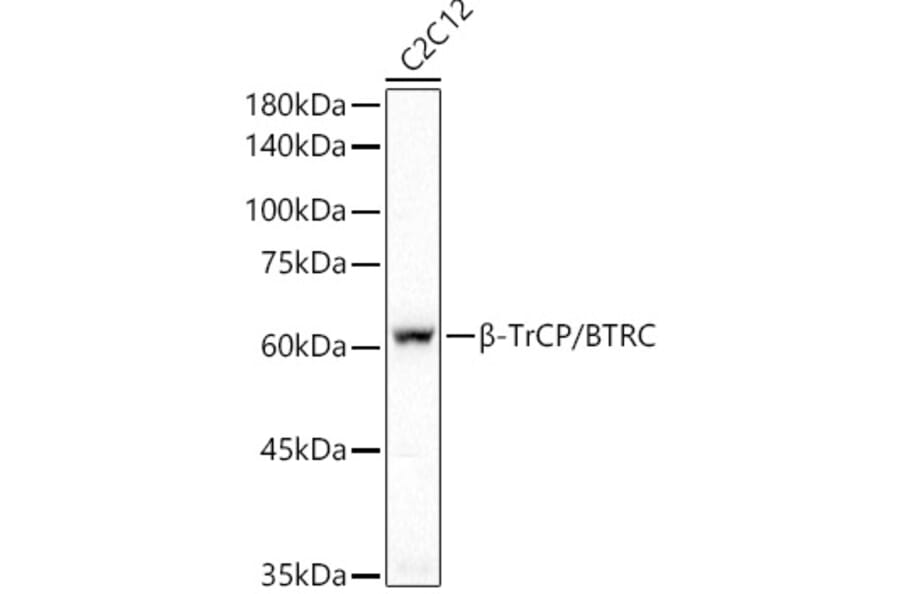 Western Blot - Anti-Beta TRCP/HOS Antibody [ARC51997] (A307150) - Antibodies.com