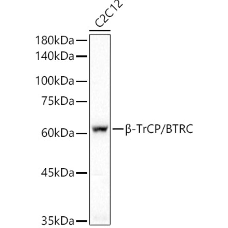 Western Blot - Anti-Beta TRCP/HOS Antibody [ARC51997] (A307150) - Antibodies.com