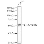 Western Blot - Anti-Beta TRCP/HOS Antibody [ARC51997] (A307150) - Antibodies.com
