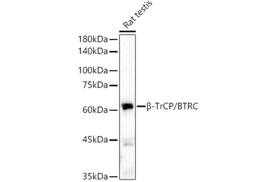 Western Blot - Anti-Beta TRCP/HOS Antibody [ARC51997] (A307150) - Antibodies.com