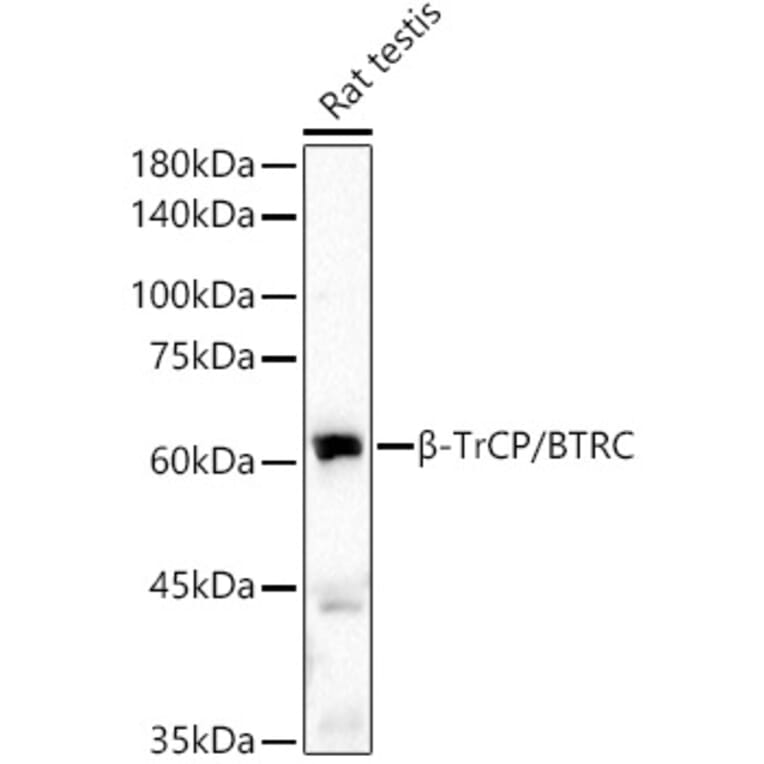 Western Blot - Anti-Beta TRCP/HOS Antibody [ARC51997] (A307150) - Antibodies.com