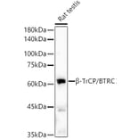 Western Blot - Anti-Beta TRCP/HOS Antibody [ARC51997] (A307150) - Antibodies.com