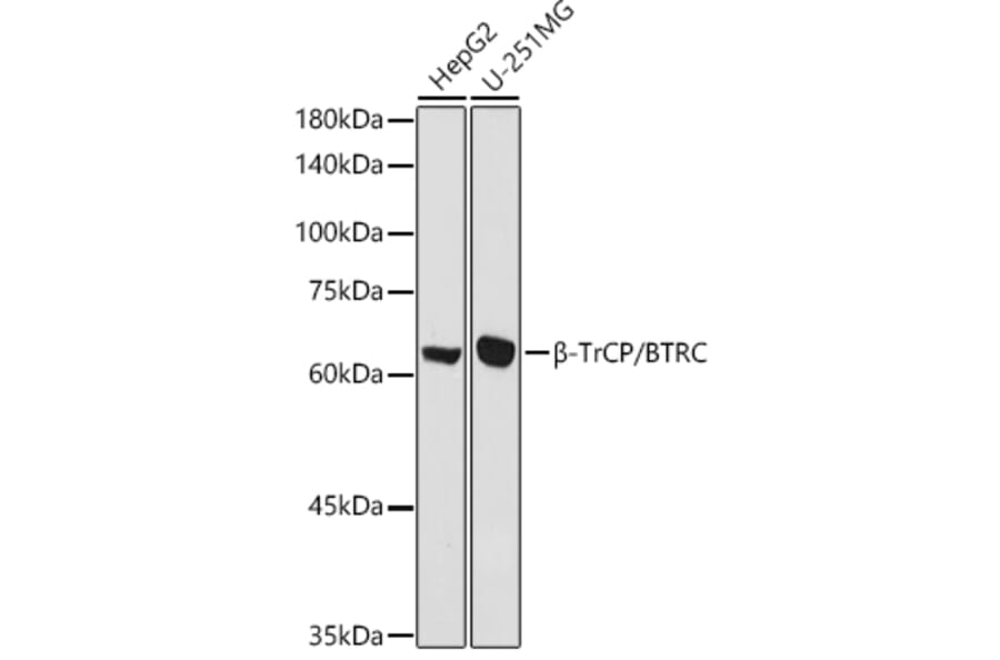 Western Blot - Anti-Beta TRCP / HOS Antibody (A307151) - Antibodies.com