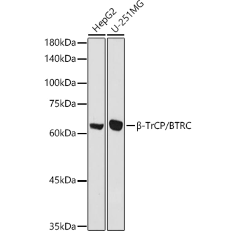 Western Blot - Anti-Beta TRCP / HOS Antibody (A307151) - Antibodies.com